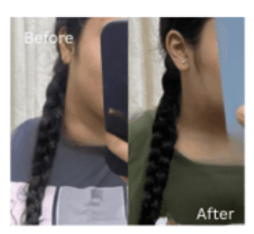 Reduces Hairfall