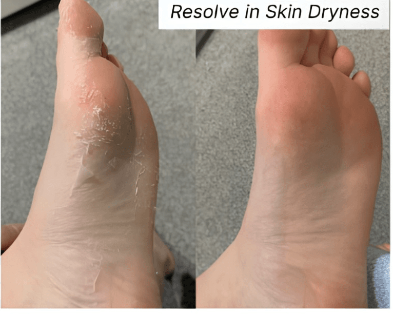 Helps reduce skin dryness