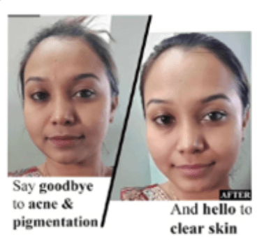 Helps with Skin Issues